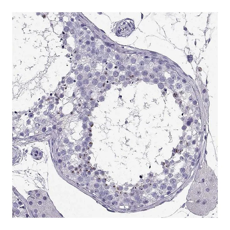Atlas Antibodies Anti-IQCD Antibody