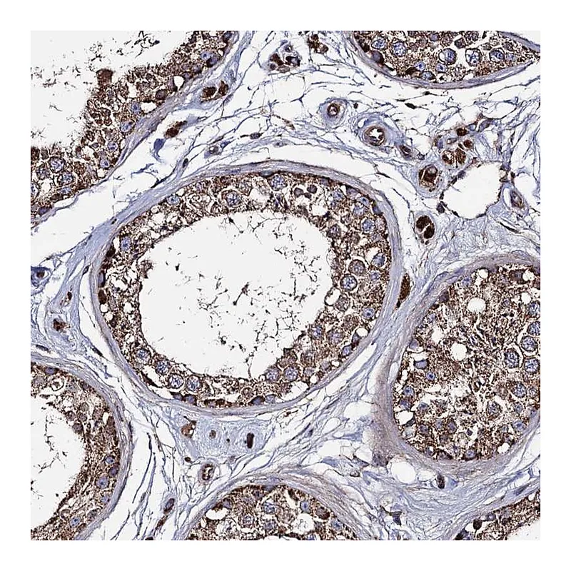 Atlas Antibodies Anti-IQCH Antibody