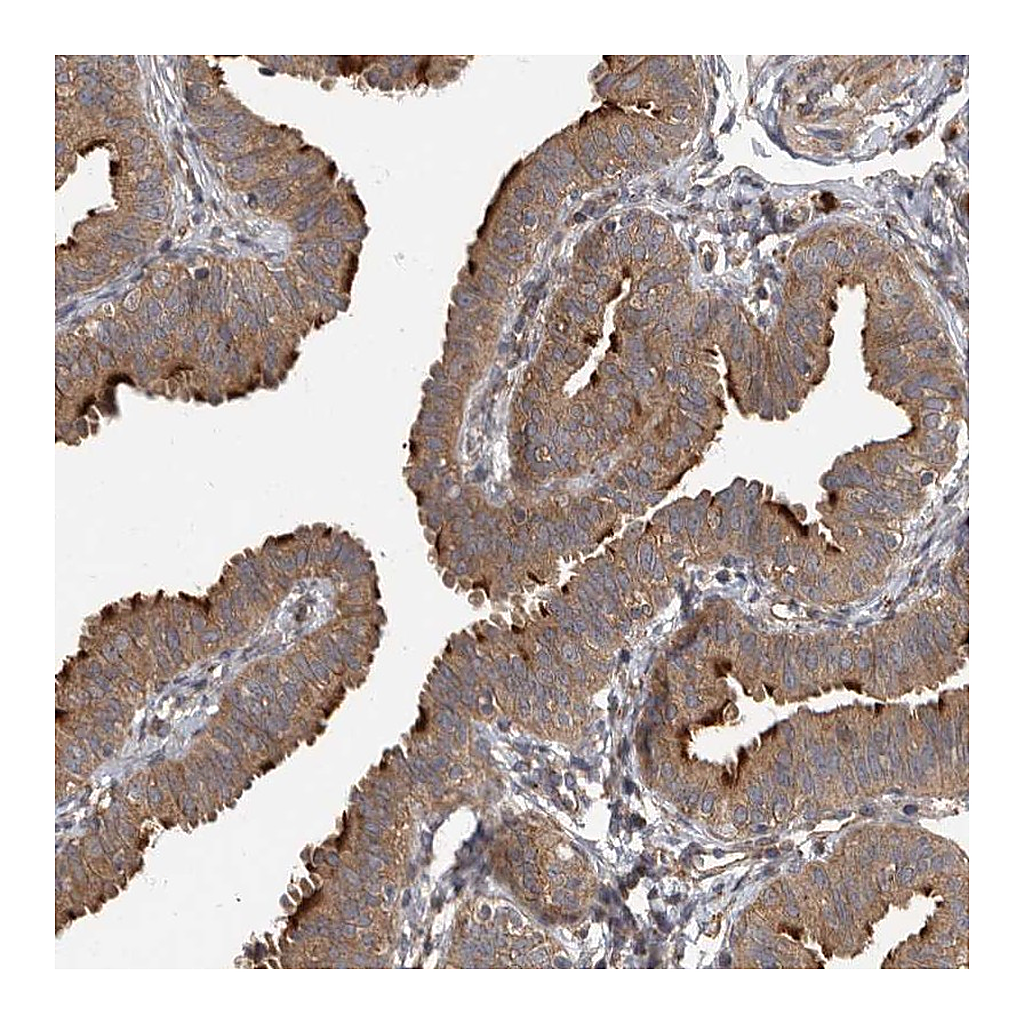 Atlas Antibodies Anti-IQCK Antibody