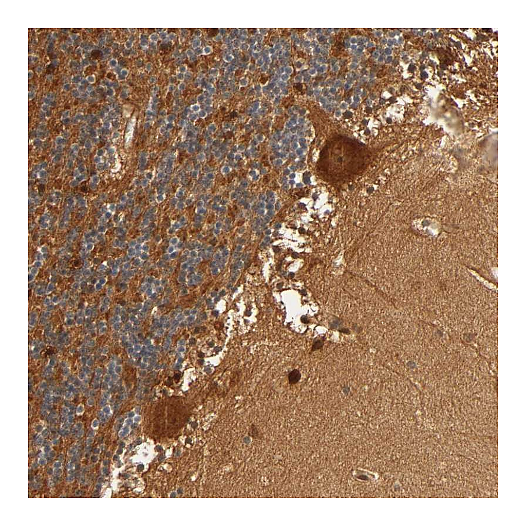 Atlas Antibodies Anti-IQCJ-SCHIP1 Antibody