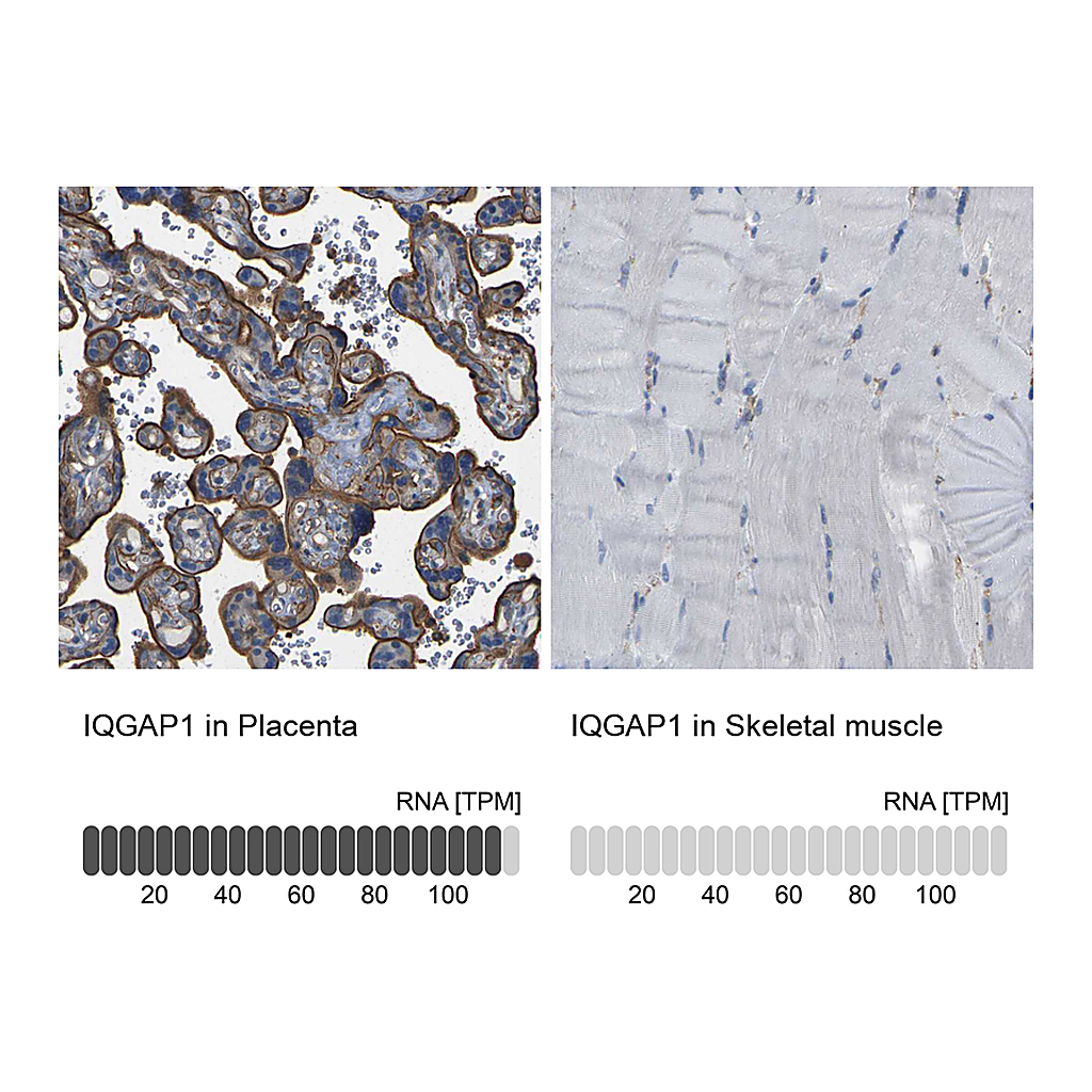 Atlas Antibodies Anti-IQGAP1 Antibody
