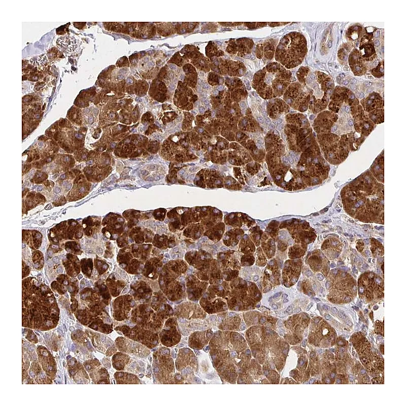Atlas Antibodies Anti-IRAK1 Antibody