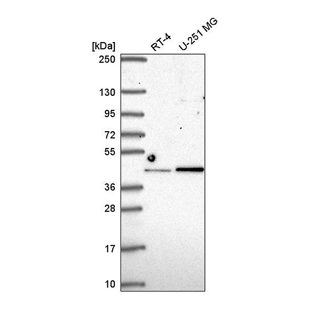 Atlas Antibodies Anti-IRF2 Antibody