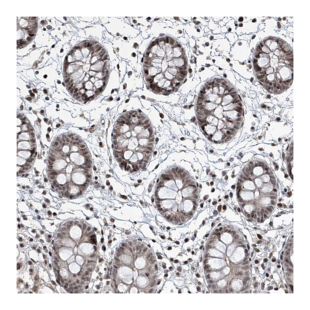 Atlas Antibodies Anti-IRF2 Antibody