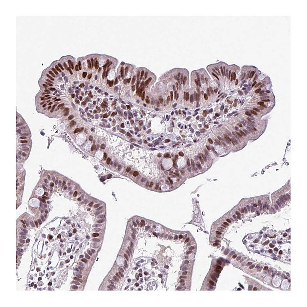 Atlas Antibodies Anti-IRF1 Antibody