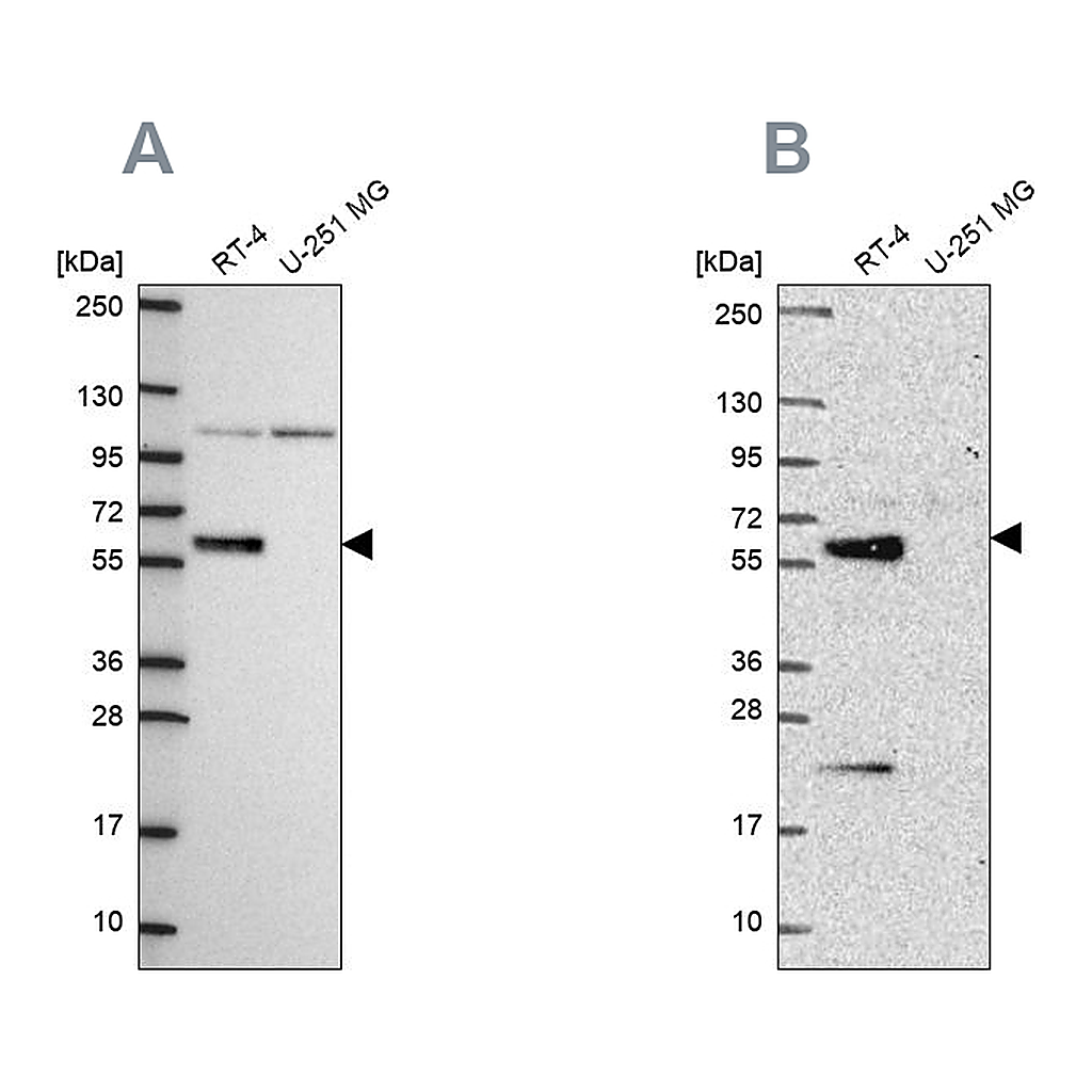 Atlas Antibodies Anti-IRF6 Antibody