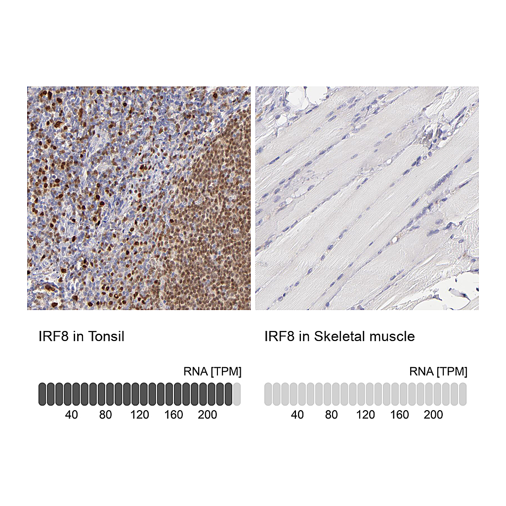Atlas Antibodies Anti-IRF8 Antibody