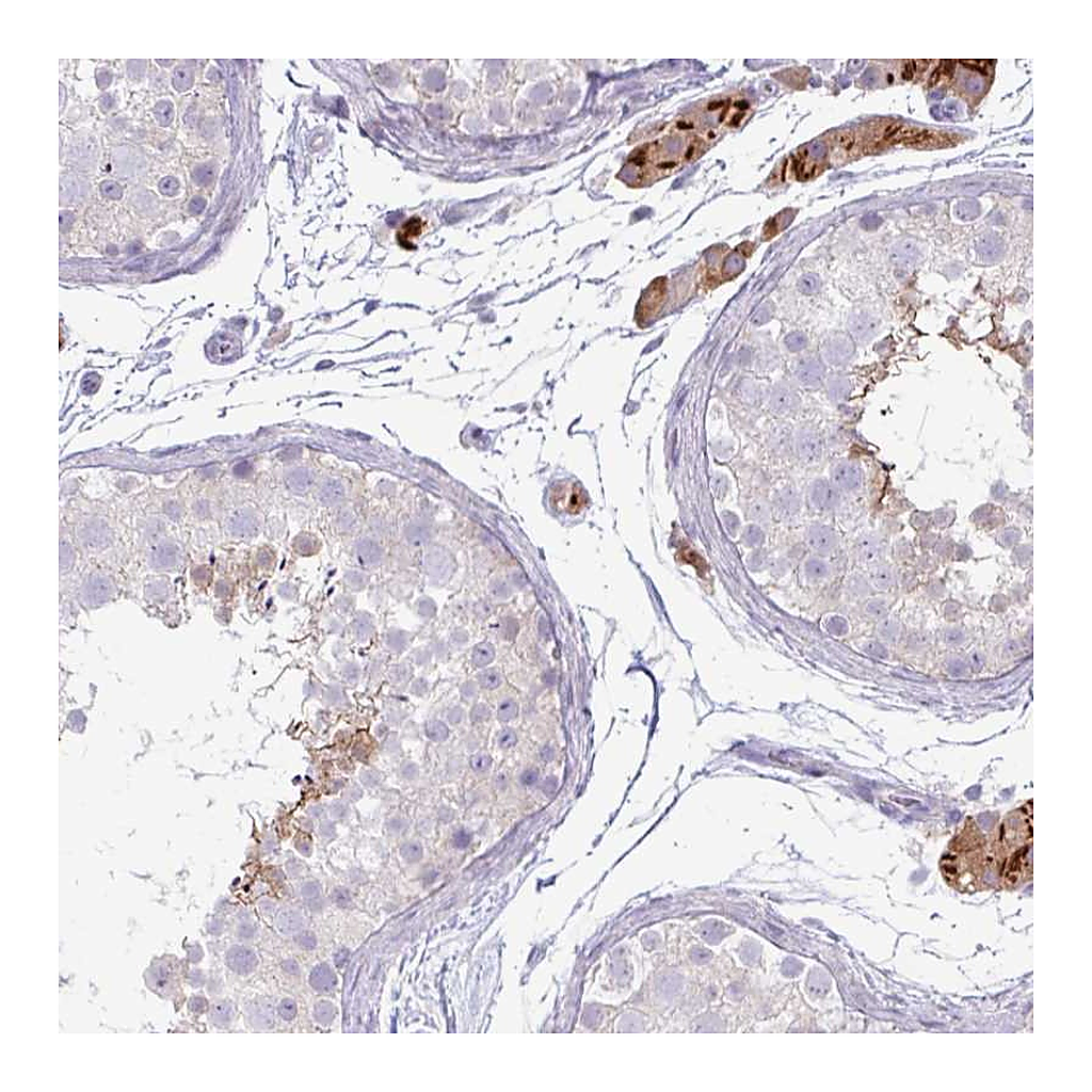 Atlas Antibodies Anti-IRGC Antibody