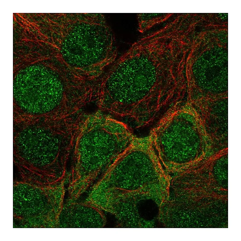 Atlas Antibodies Anti-IRS1 Antibody