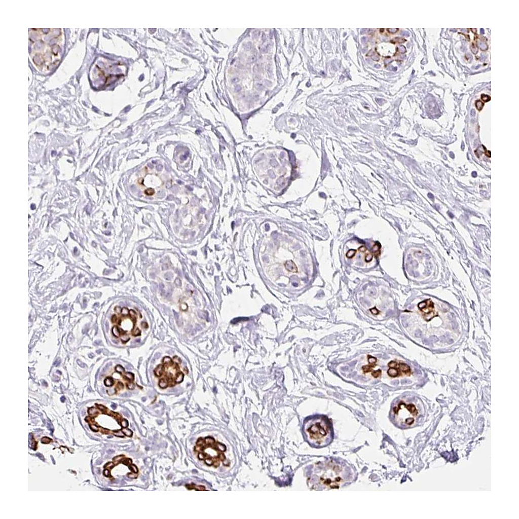 Atlas Antibodies Anti-IRX2 Antibody