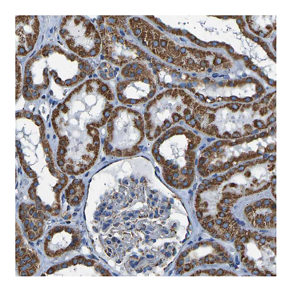 Atlas Antibodies Anti-IRX6 Antibody