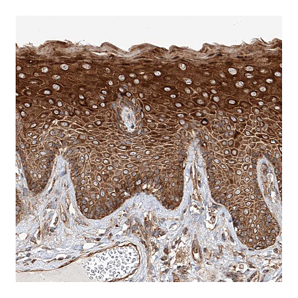 Atlas Antibodies Anti-ISCA2 Antibody
