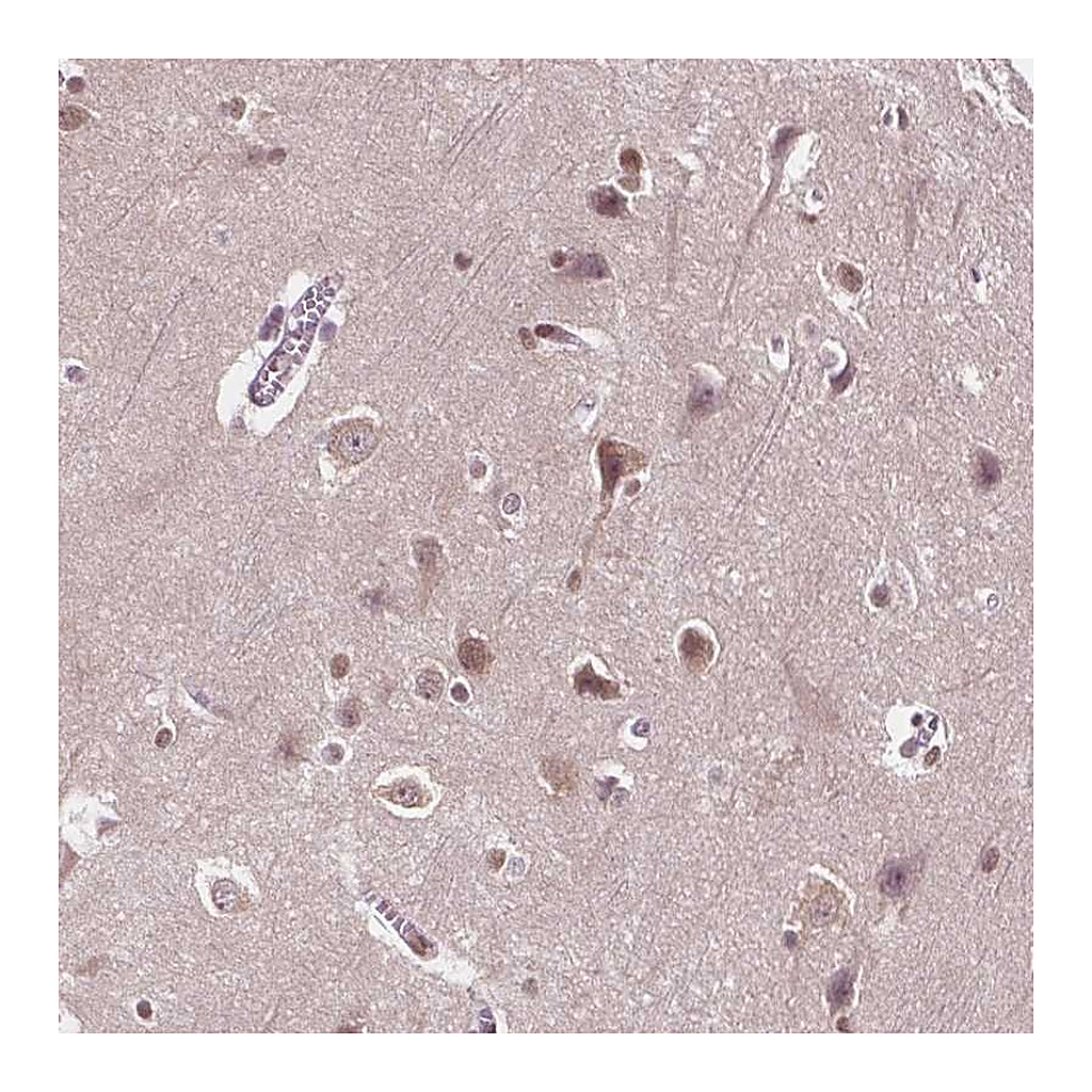 Atlas Antibodies Anti-ISLR2 Antibody