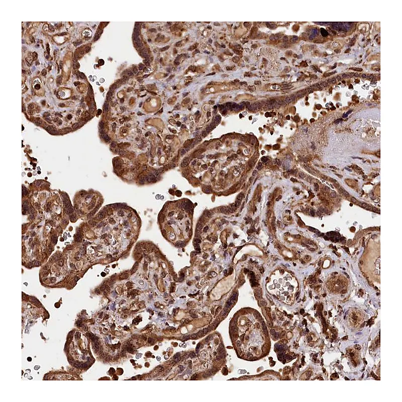 Atlas Antibodies Anti-IST1 Antibody