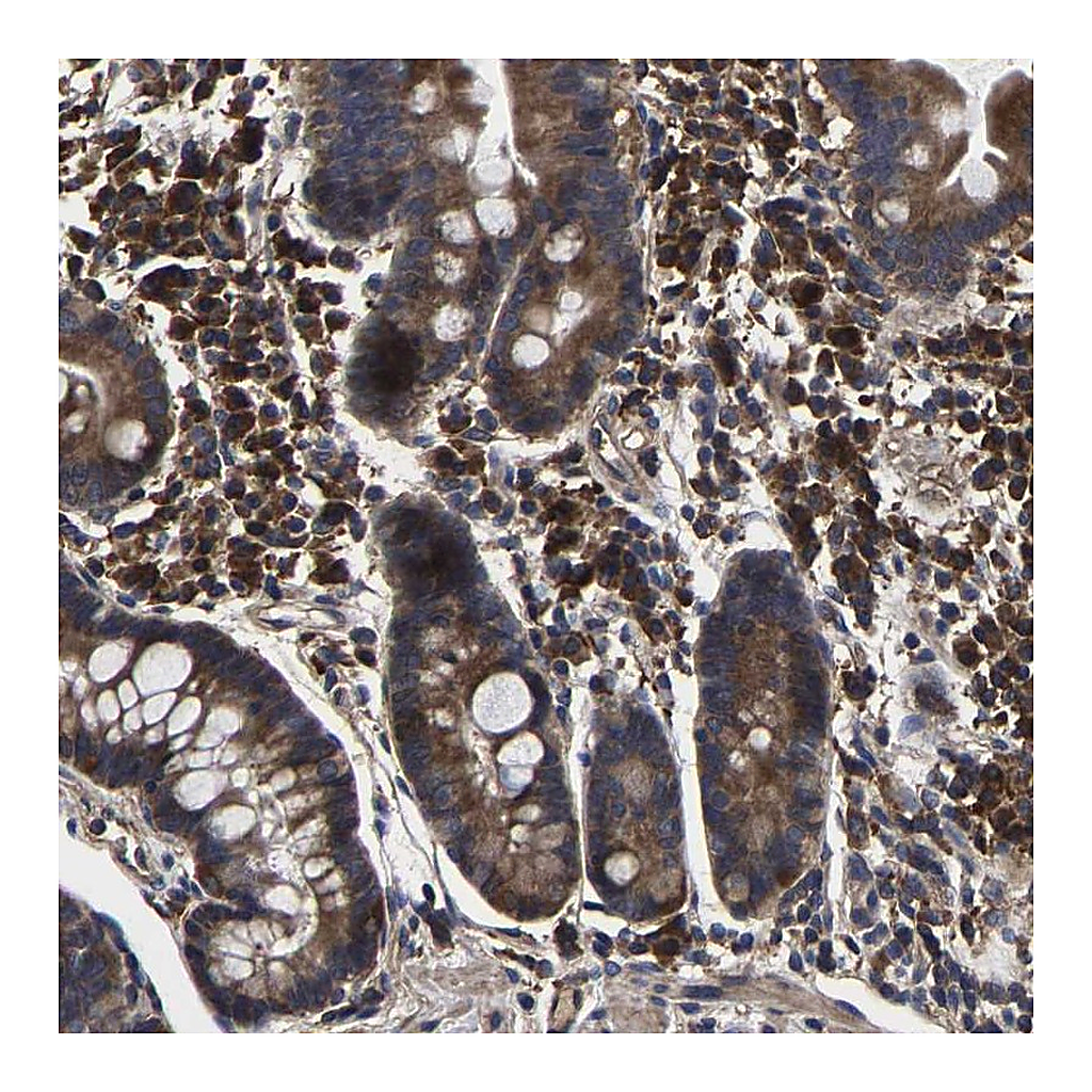 Atlas Antibodies Anti-ITCH Antibody