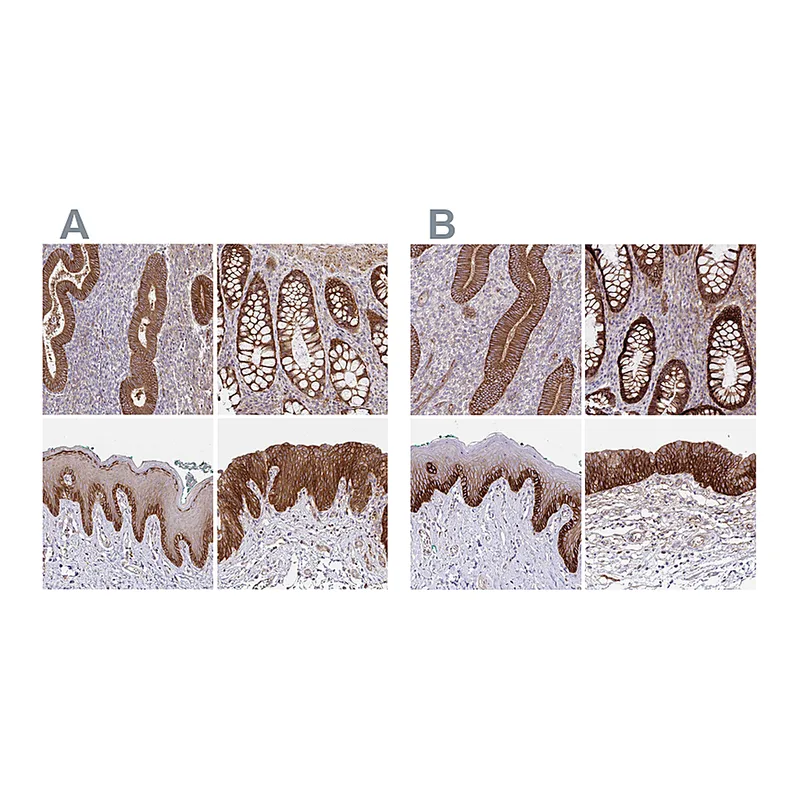 Atlas Antibodies Anti-ITGA2 Antibody