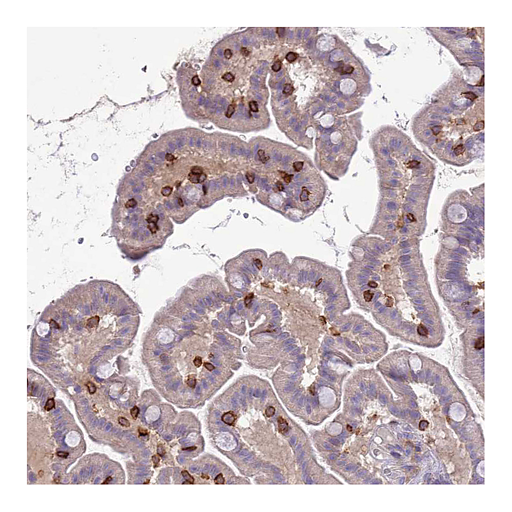 Atlas Antibodies Anti-ITGAE Antibody