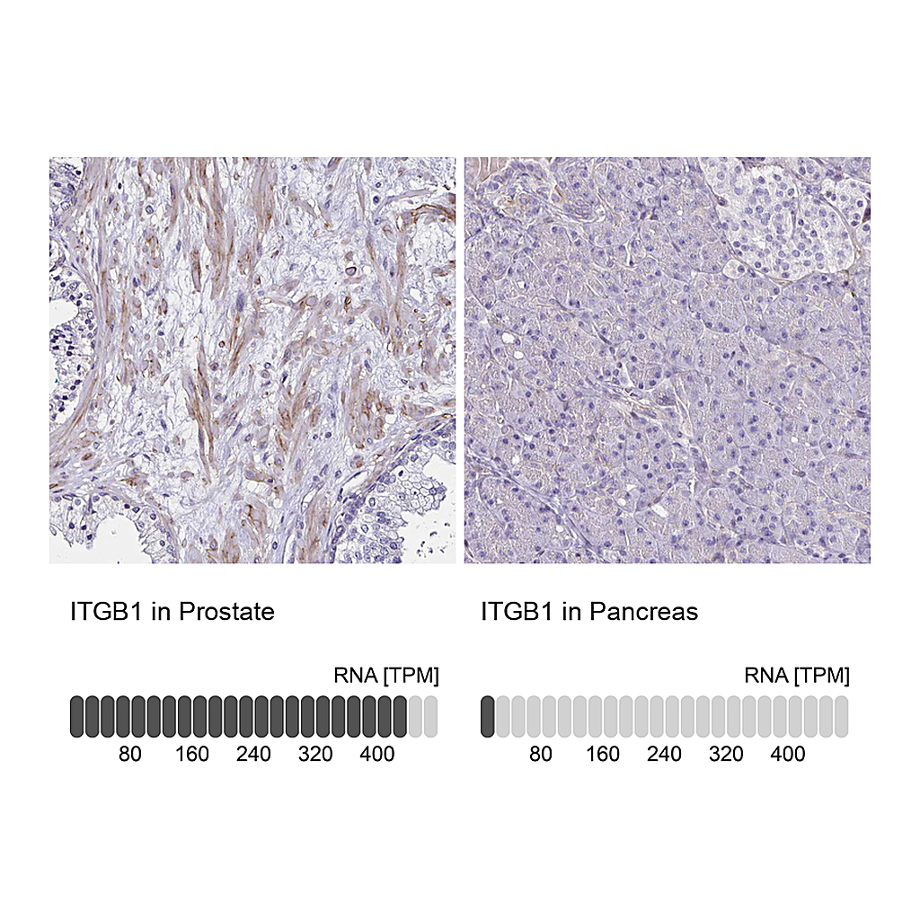 Atlas Antibodies Anti-ITGB1 Antibody