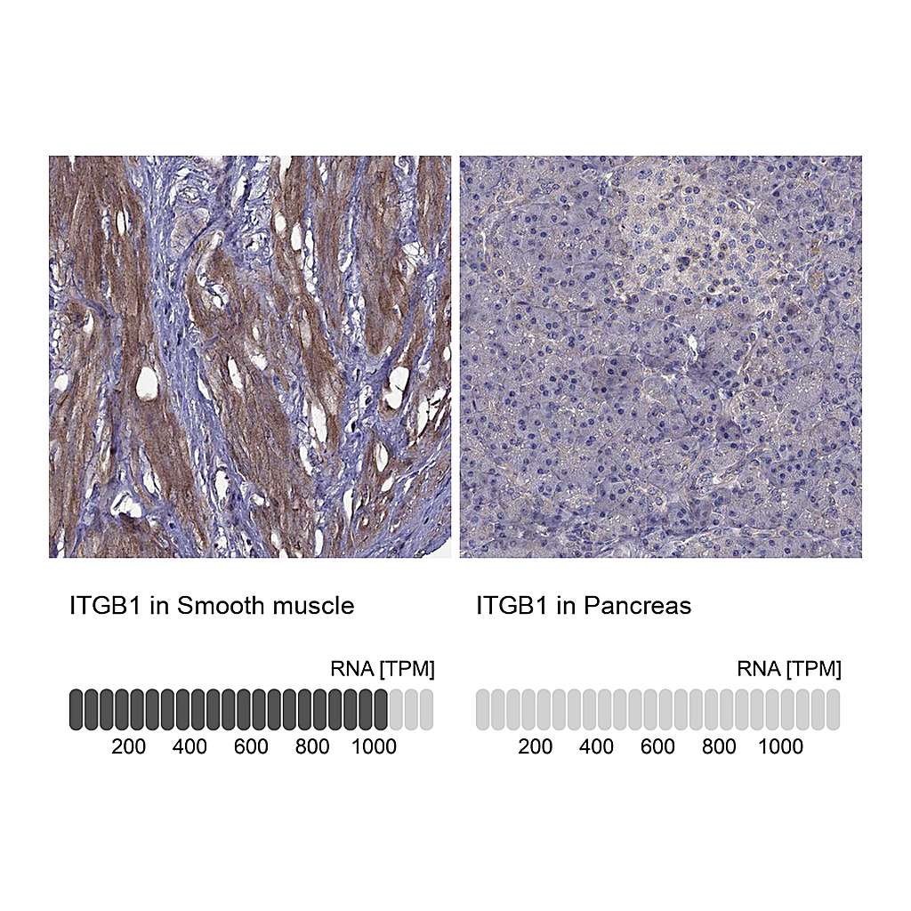 Atlas Antibodies Anti-ITGB1 Antibody