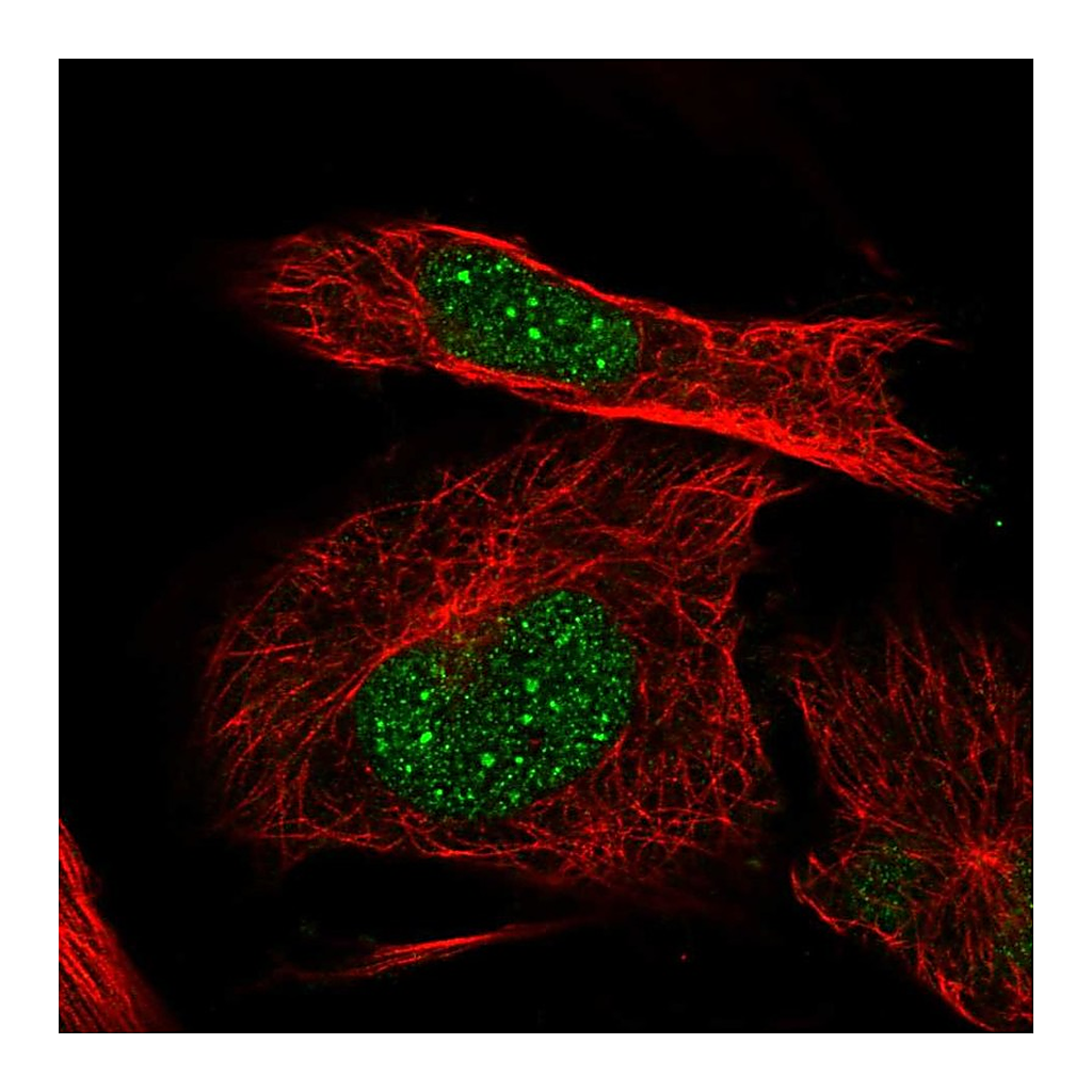 Atlas Antibodies Anti-ITGB1BP1 Antibody