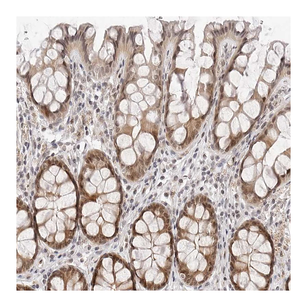 Atlas Antibodies Anti-ITGB3BP Antibody
