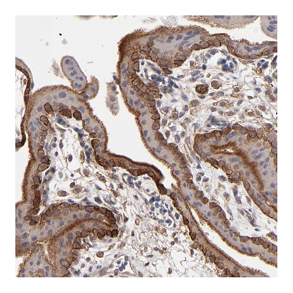Atlas Antibodies Anti-ITGB5 Antibody
