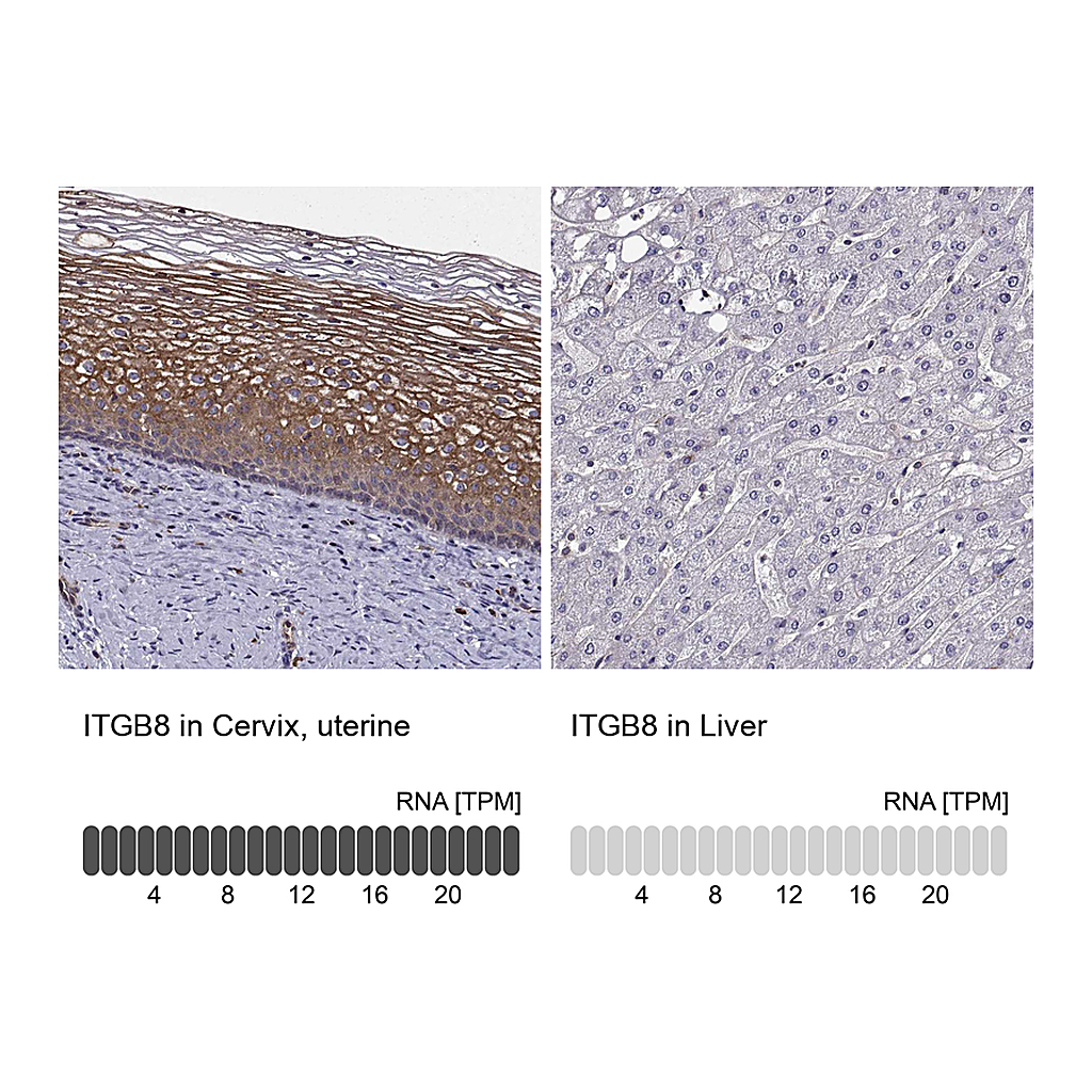 Atlas Antibodies Anti-ITGB8 Antibody