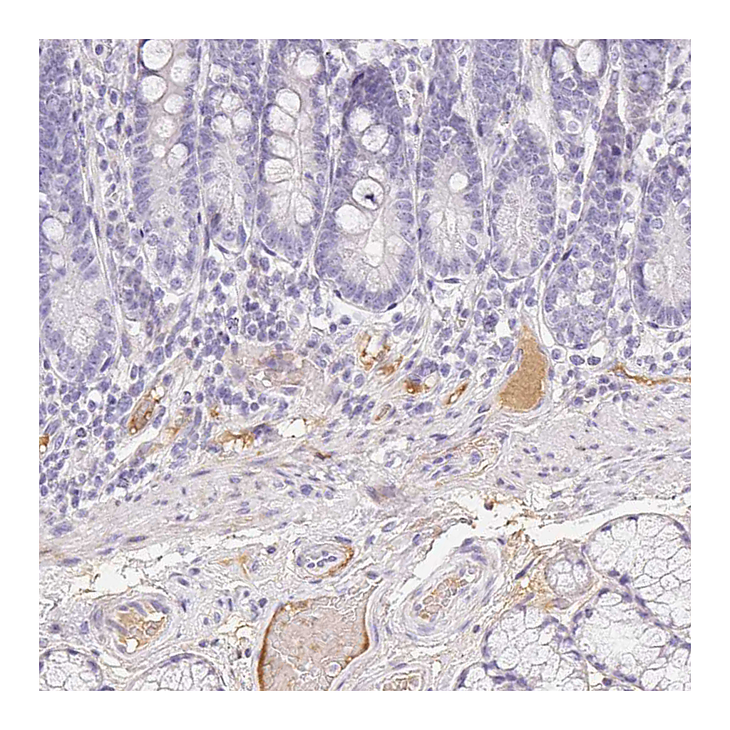Atlas Antibodies Anti-ITIH2 Antibody