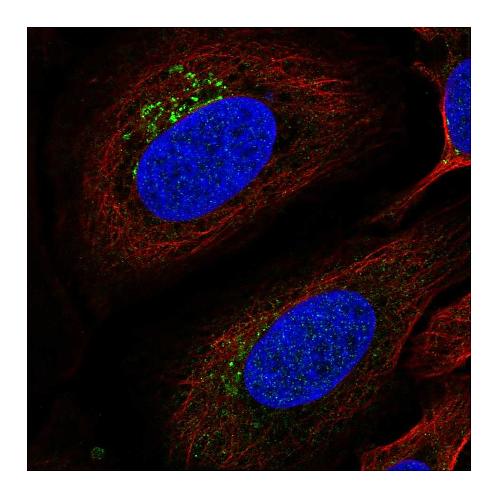 Atlas Antibodies Anti-ITM2B Antibody