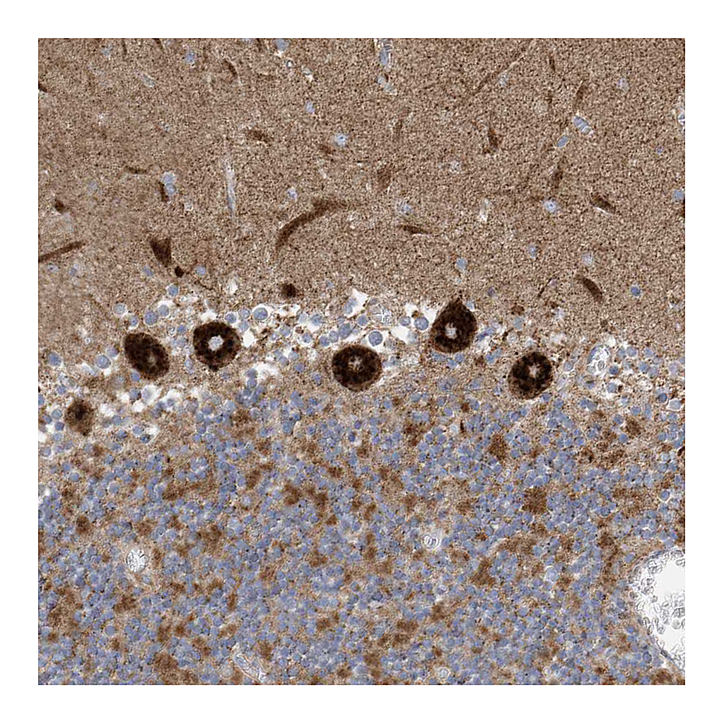 Atlas Antibodies Anti-ITM2B Antibody