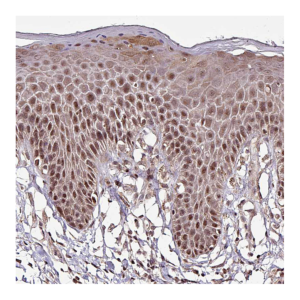 Atlas Antibodies Anti-ITPKC Antibody