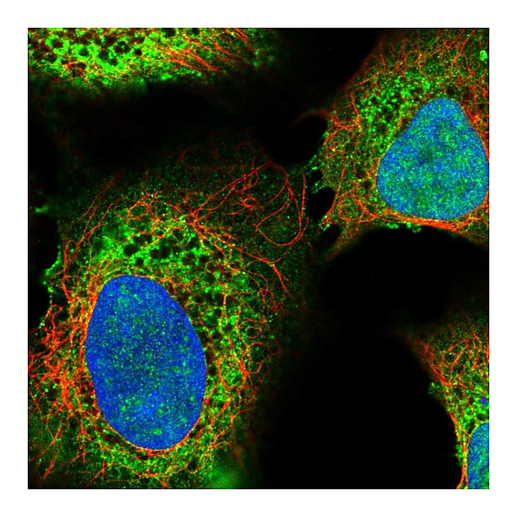 Atlas Antibodies Anti-ITPR2 Antibody