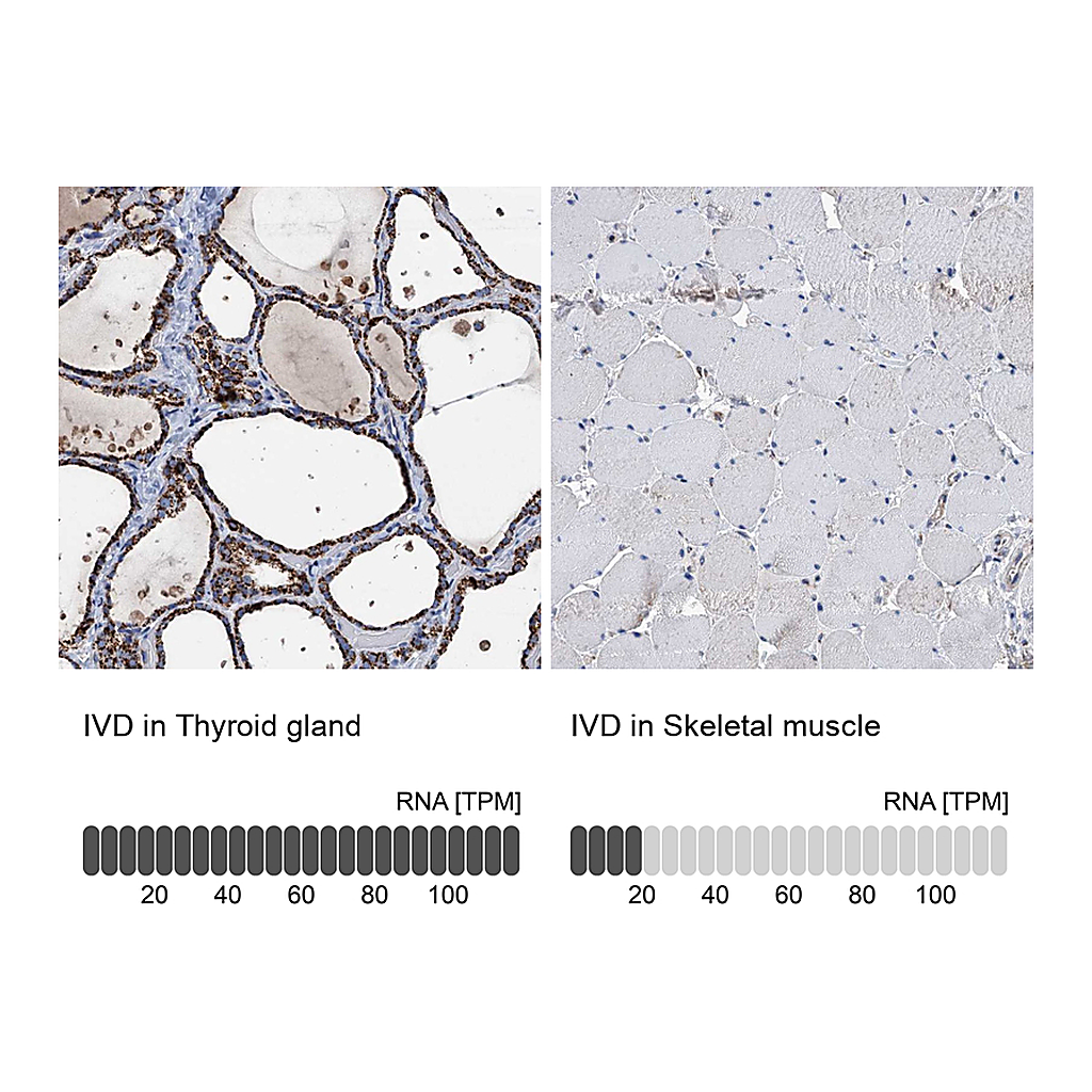 Atlas Antibodies Anti-IVD Antibody