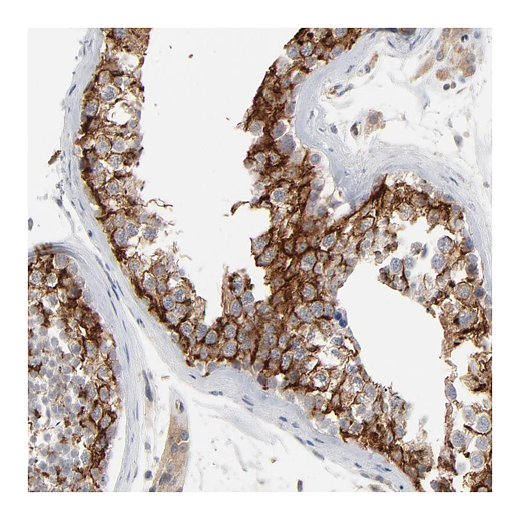 Atlas Antibodies Anti-ITPR3 Antibody
