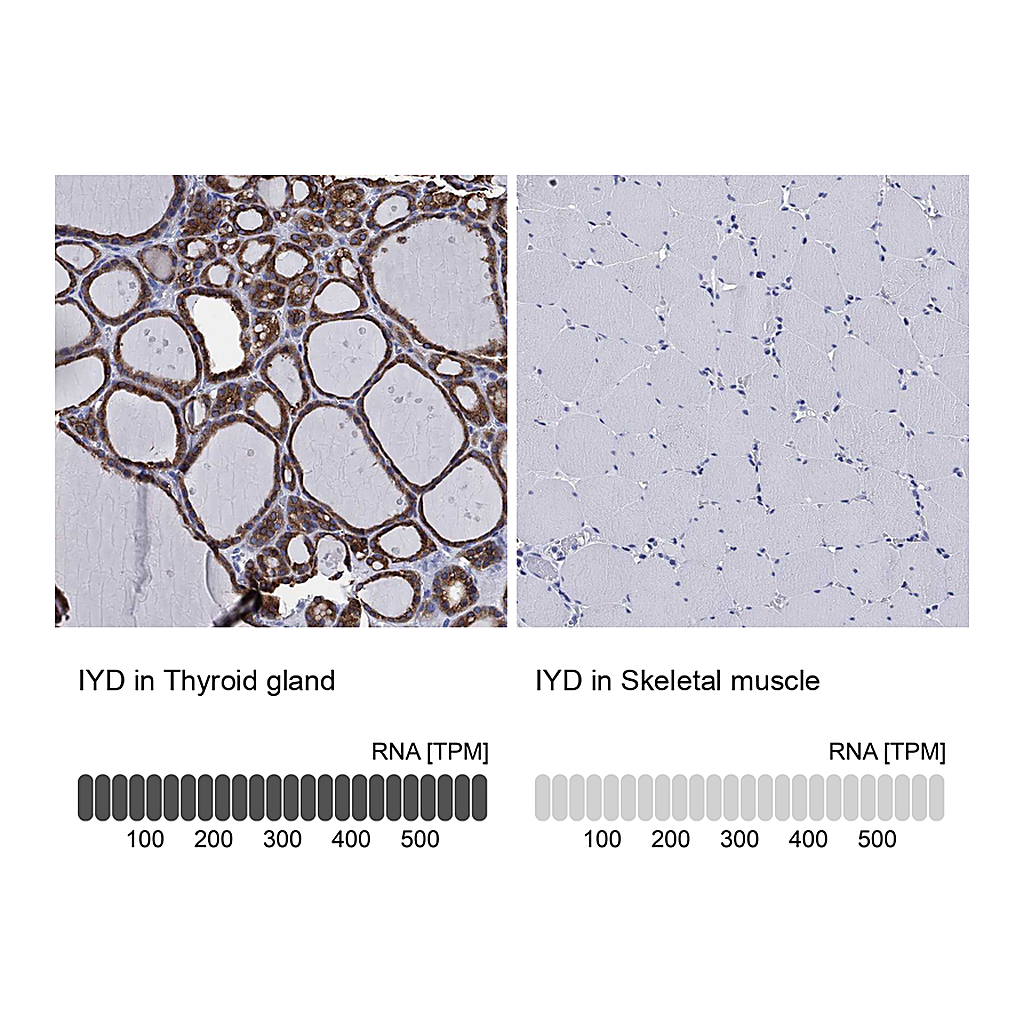 Atlas Antibodies Anti-IYD Antibody