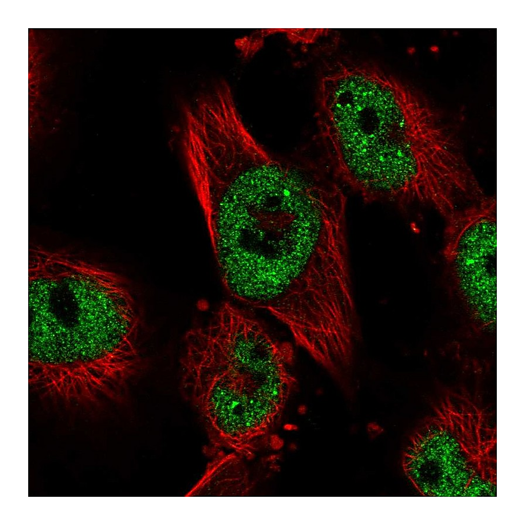 Atlas Antibodies Anti-JADE2 Antibody