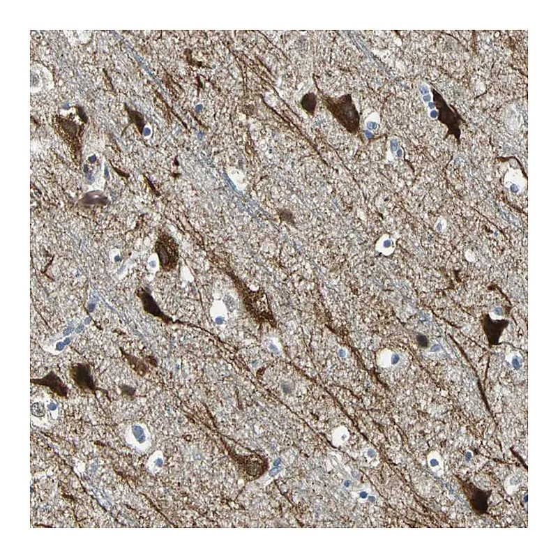 Atlas Antibodies Anti-JADE3 Antibody