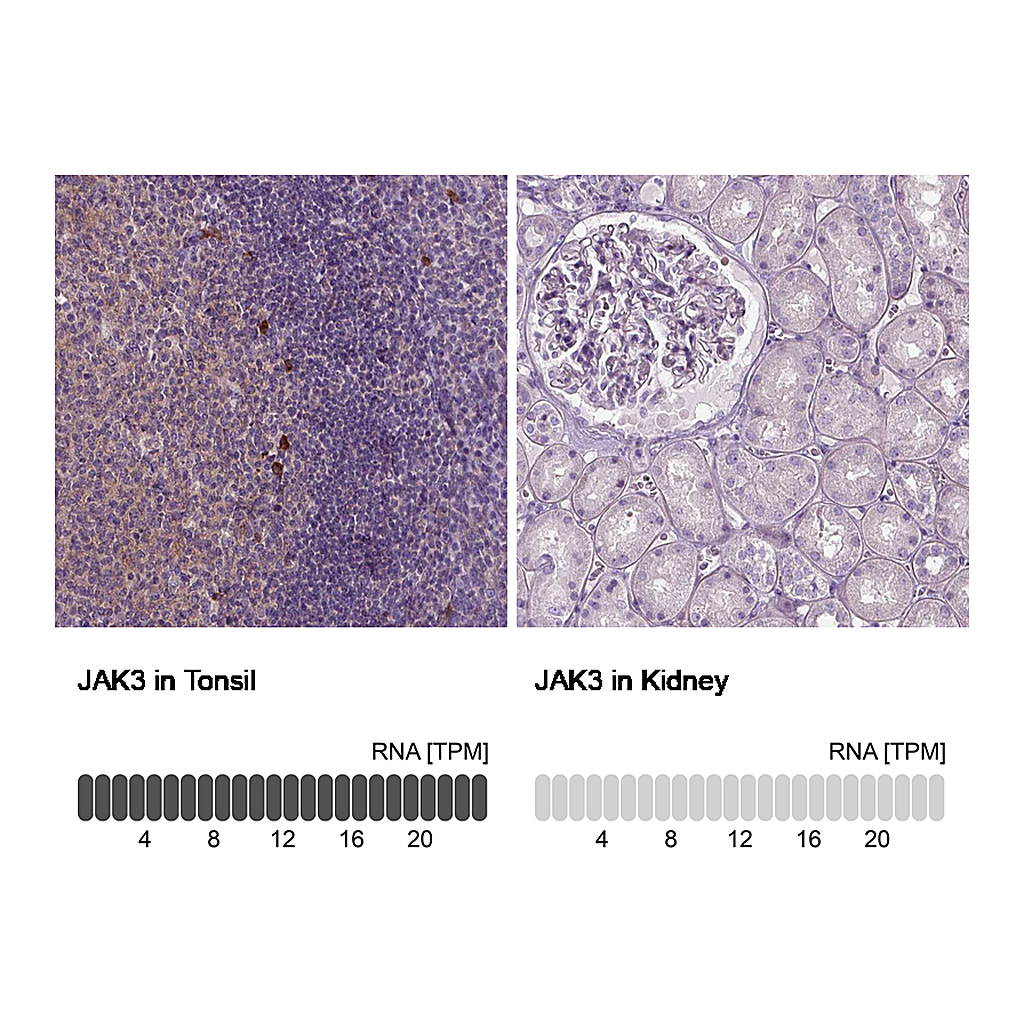Atlas Antibodies Anti-JAK3 Antibody