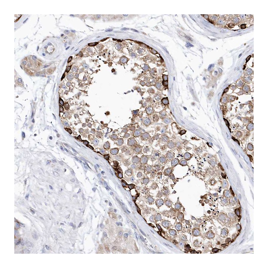 Atlas Antibodies Anti-JKAMP Antibody