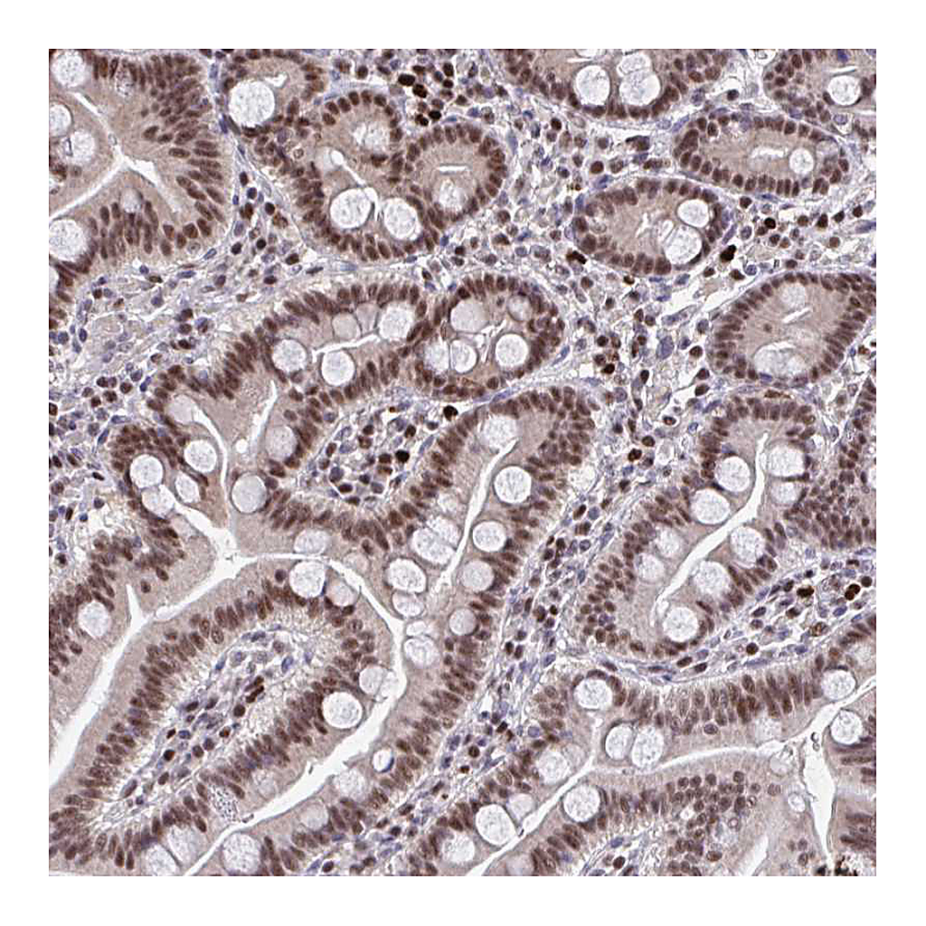 Atlas Antibodies Anti-JDP2 Antibody