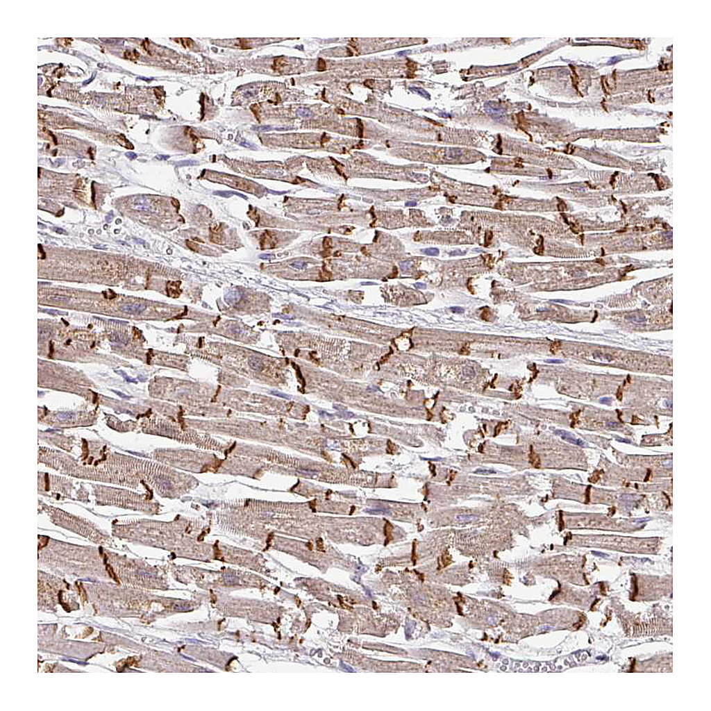 Atlas Antibodies Anti-JPH2 Antibody