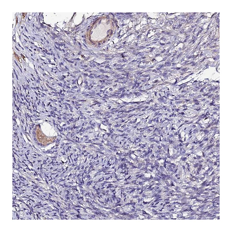 Atlas Antibodies Anti-JRKL Antibody