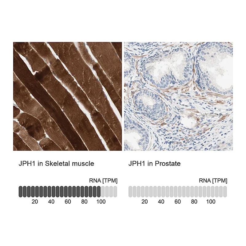 Atlas Antibodies Anti-JPH1 Antibody