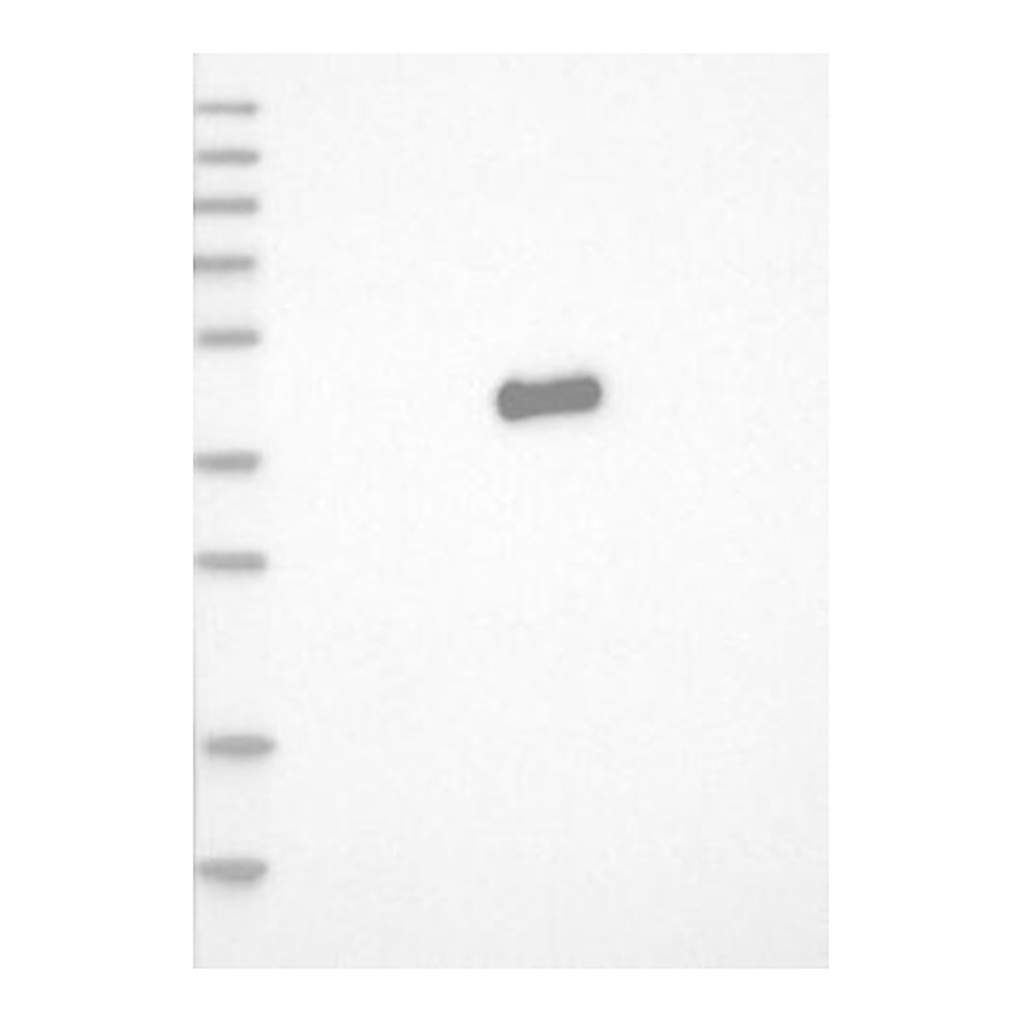 Atlas Antibodies Anti-JUN Antibody