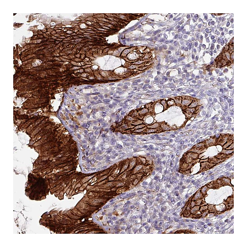 Atlas Antibodies Anti-JUP Antibody