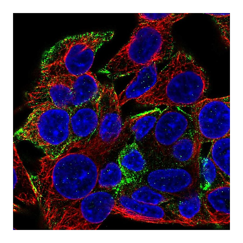 Atlas Antibodies Anti-KANK1 Antibody