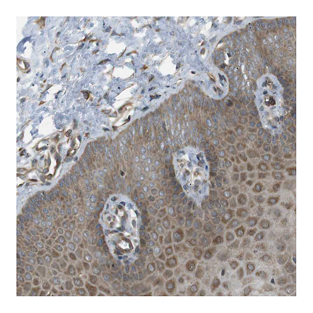 Atlas Antibodies Anti-KANK2 Antibody