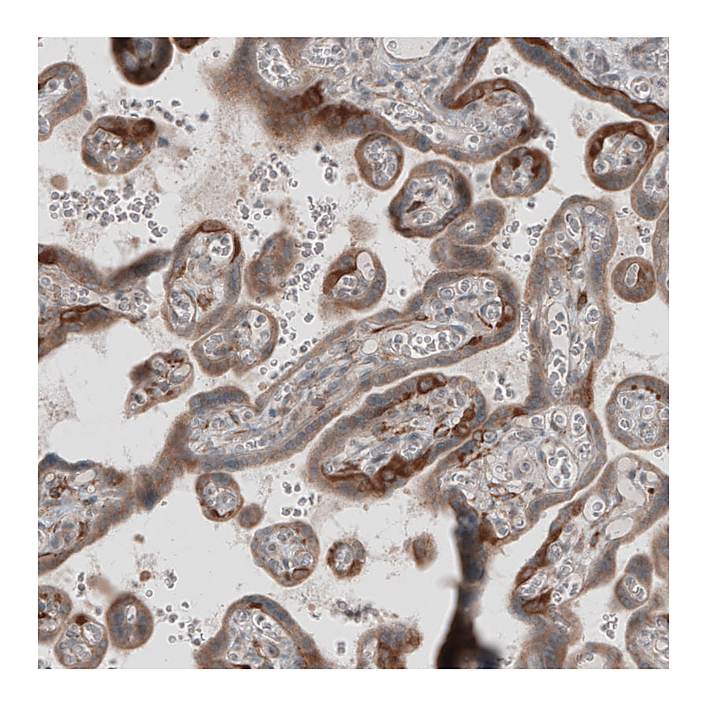 Atlas Antibodies Anti-KANK4 Antibody