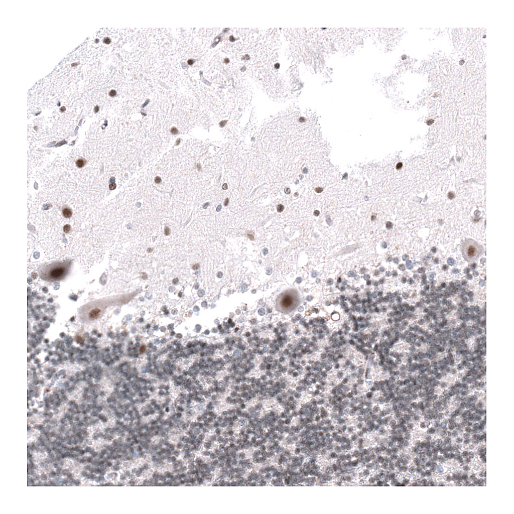Atlas Antibodies Anti-KANSL1 Antibody