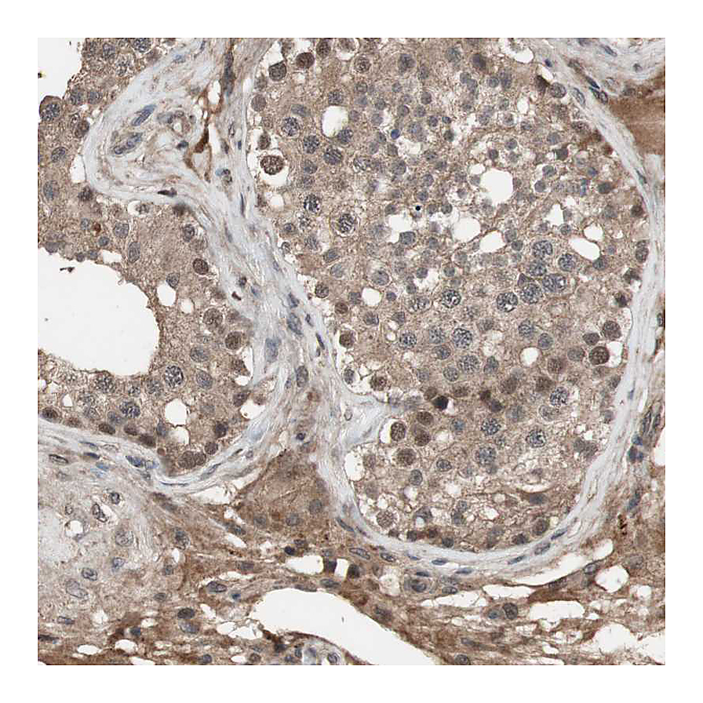 Atlas Antibodies Anti-KANSL1 Antibody